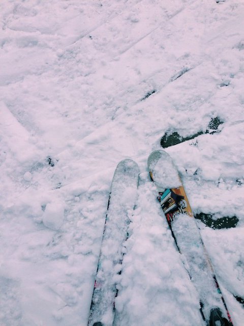 Surgery Prep and Dealing With Season Enders