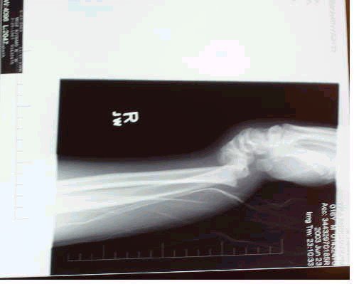 is there something wrong with this xray
