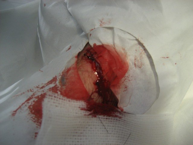 Stitches!!!
