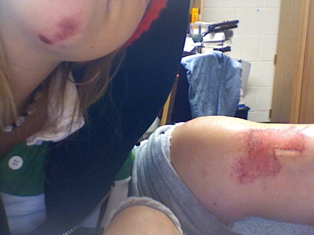 Longboard crash