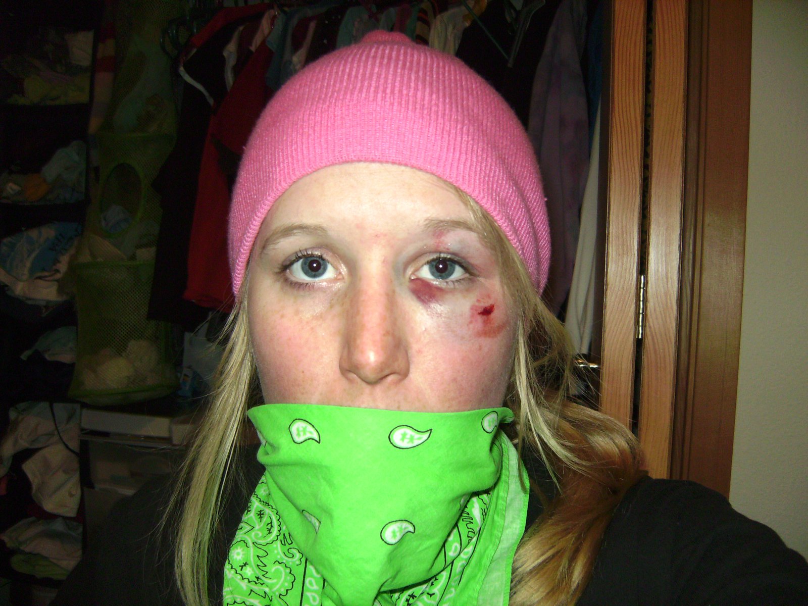 Sometimes skiing hurts