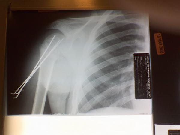 X-rayz