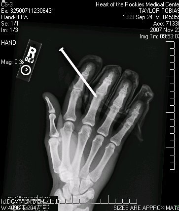 Hand vs nail gun