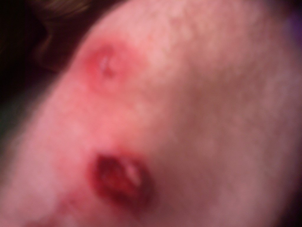 Knee