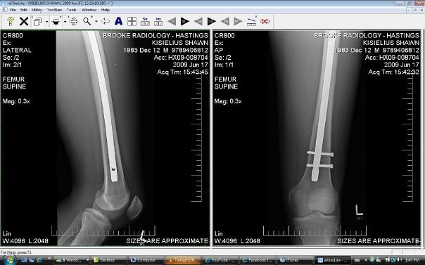 Side view xray