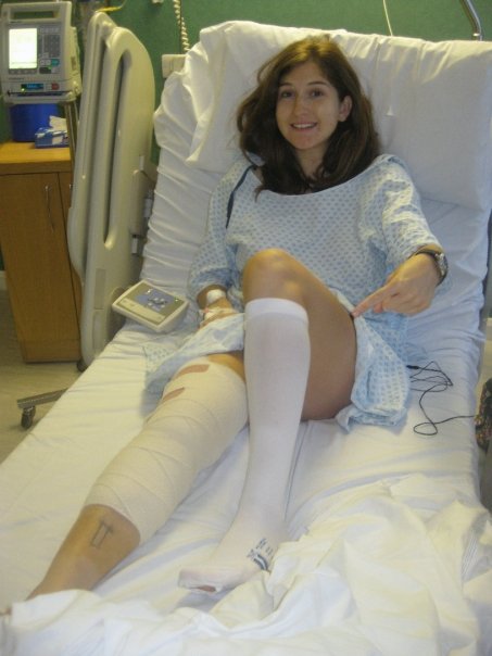 Acl surgery