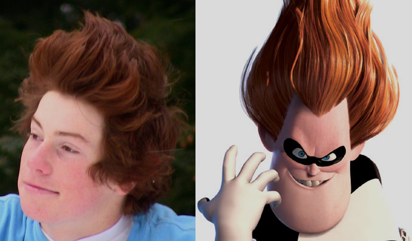Lloyd and Syndrome