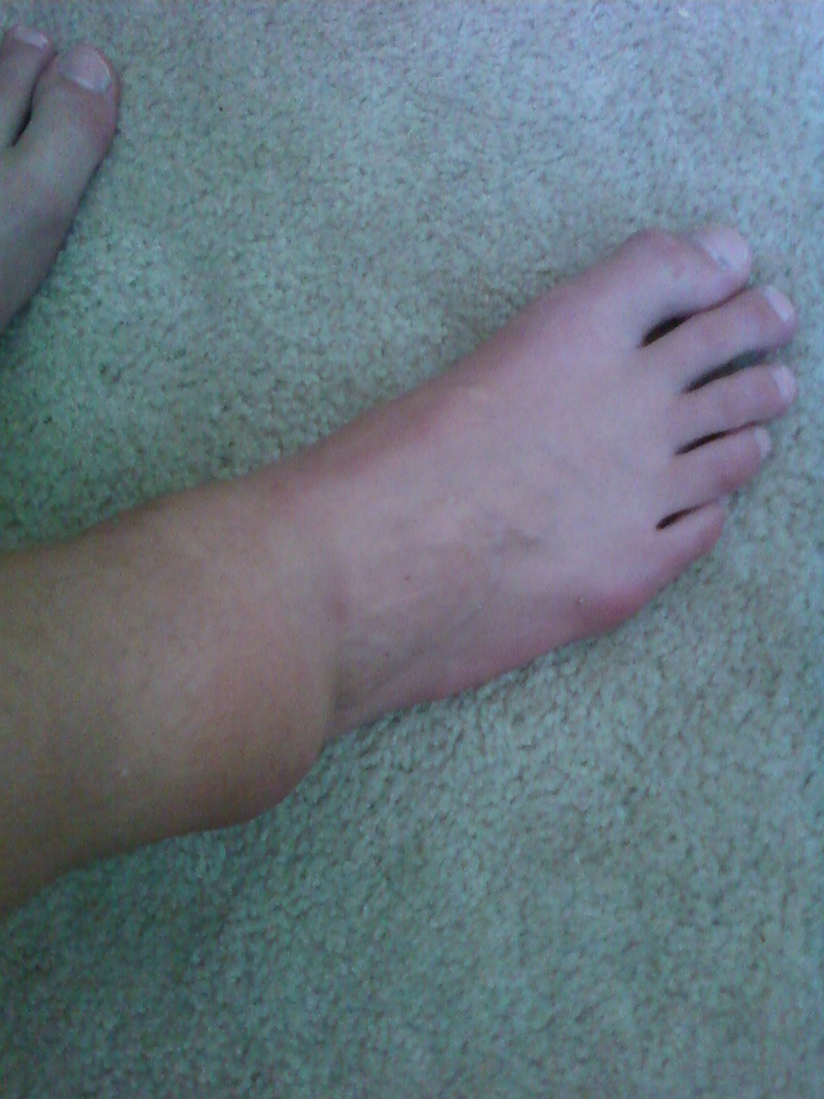 My ankle