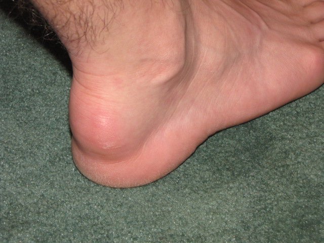 Foot 4