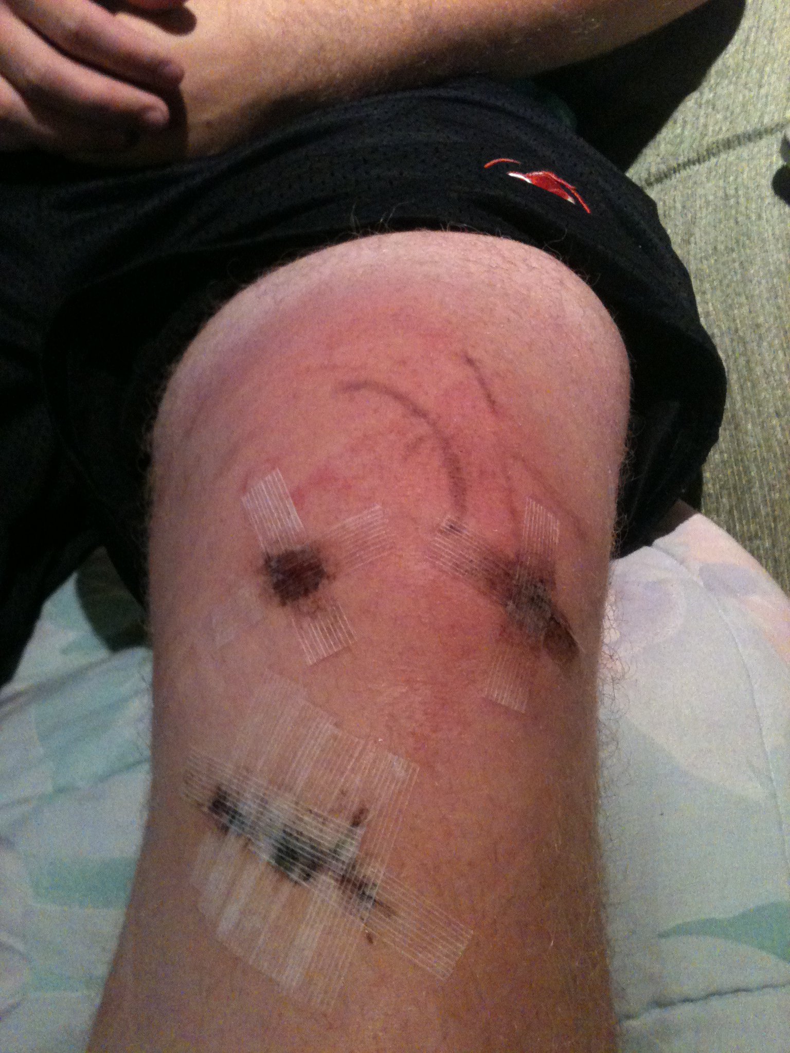 New knee